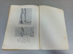 W   1976年  山西卫生出版社出版   中山医学院编写组编   《内科疾病鉴别诊断学》  一册全！！！