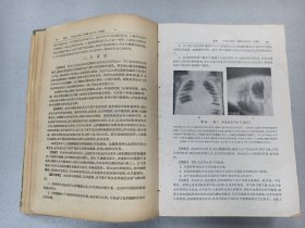 W   1958年    人民卫生出版社出版   诸福棠主编   《实用儿科学》  下卷  一厚册！！！