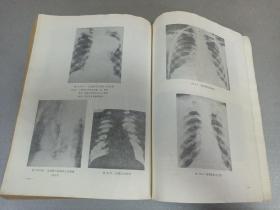 W   1976年  山西卫生出版社出版   中山医学院编写组编   《内科疾病鉴别诊断学》  一册全！！！