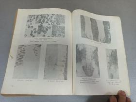 W   1976年  山西卫生出版社出版   中山医学院编写组编   《内科疾病鉴别诊断学》  一册全！！！