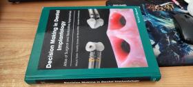 【英文原版】Decision Making in Dental Implantology: Atlas of Surgical and Restorative Approaches (English Edition)牙种植学的决策:外科和修复方法图谱