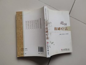 图解拔罐疗法