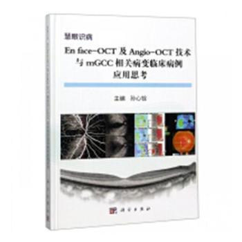 En face-OCT及Angio-OCT技术与mGCC相关病变临床病变应用思考