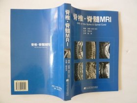 脊椎·脊髓MRI