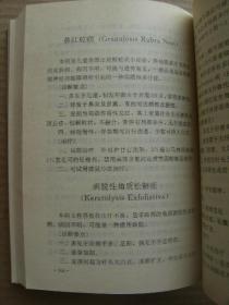 皮肤病性病诊疗手册 白义杰主编 辽宁科学技术出版社 [前言 皮肤病的诊断-治疗-护理 皮肤的卫生保健 病毒性-细菌性皮肤病 真菌病 动物性-物理性-职业性皮肤病 红斑和丘疹鳞屑性皮肤病 皮炎湿疹类-荨麻疹及痒疹类皮肤病 红皮病 结缔组织病及有关免疫性疾病 大疱性-血管性-无菌性脓疱性-内分泌代谢营养障碍性皮肤病 非感染性肉芽肿 角化过度和萎缩性-色素障碍性-遗传性皮肤病 皮脂腺汗腺疾病