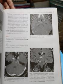 颅神经解剖、病理及影像图谱