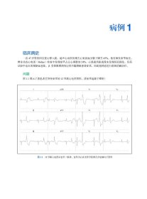 应用心电图定位室性心律失常的起源与消融