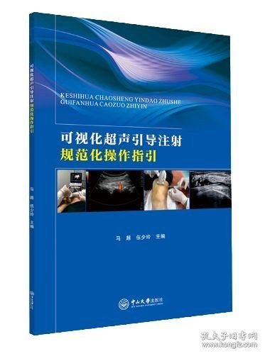 可视化超声引导注射规范化操作指引