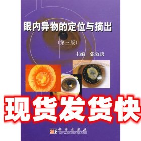 眼内异物的定位与摘出 张效房　主编 科学出版社 9787030217684