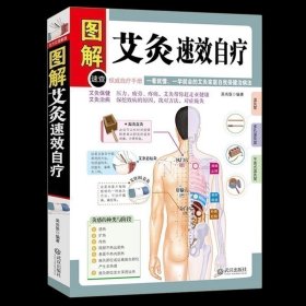 【原版闪电发货】【新华 现货速发】 图解艾灸速效自疗 艾灸手册艾灸穴位图解学习知识 完全图解中医养生保健生活书籍中医书艾灸疗法艾灸畅销书