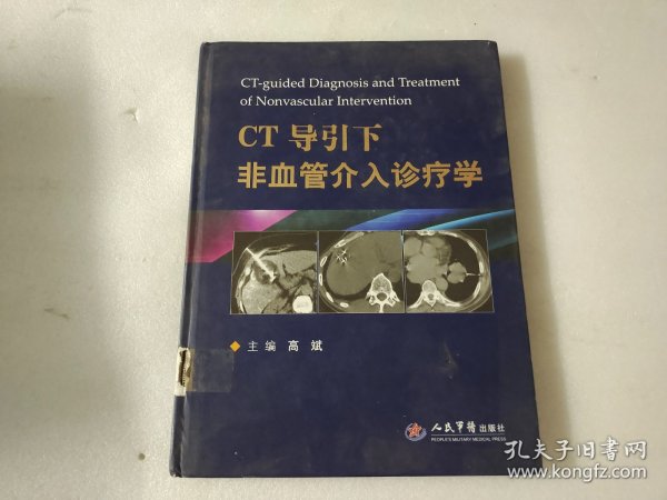 CT导引下非血管介入诊疗学