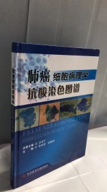 肺癌细胞病理学抗酸染色图谱