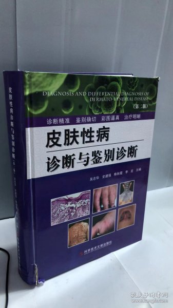皮肤性病诊断与鉴别诊断（第2版）