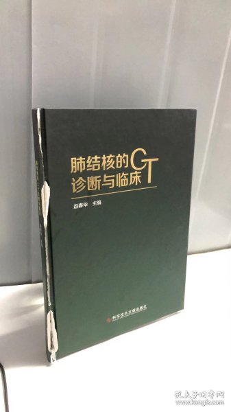 肺结核的CT诊断与临床