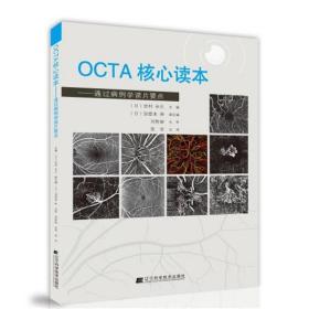 OCTA核心读本:通过病例学读片要点