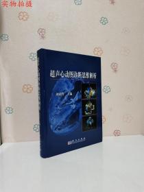 超声心动图诊断思维解析