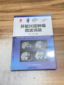 肝脏Ⅸ段肿瘤微波消融【未开封】