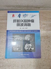 肝脏Ⅸ段肿瘤微波消融
