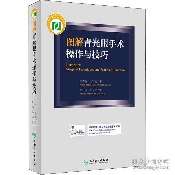 图解青光眼手术操作与技巧