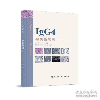 IgG4相关性疾病