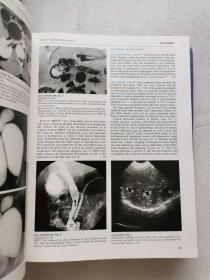 The Encyclopaedia of Medical Imaging 4. 5(医学影像学百科全书 )