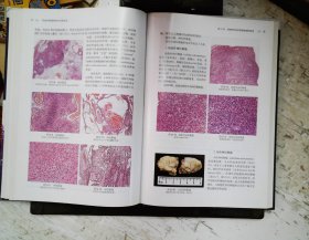软组织肿瘤病理学诊断图谱【2014年1月一版一印】