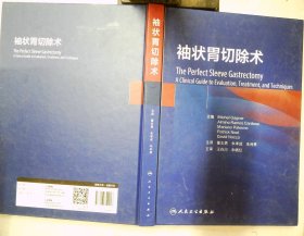 袖状胃切除术