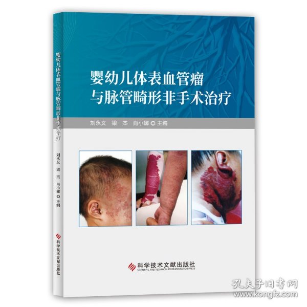 婴幼儿体表血管瘤与脉管畸形非手术治疗