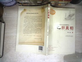 乙肝真相：计沙大夫肝病讲坛