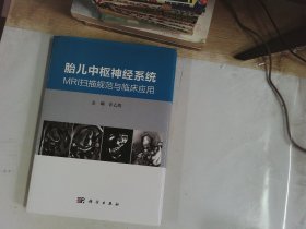 胎儿中枢神经系统MRI扫描规范与临床应用