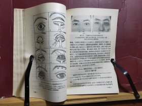 D1669   眼部成型术  全一册  人民卫生出版社  1960年10月  一版一印  仅印  4800册