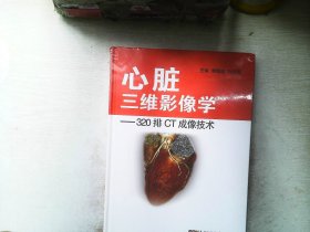 心脏三维影像学：320排CT成像技术