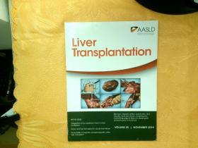 Liver Transplantation