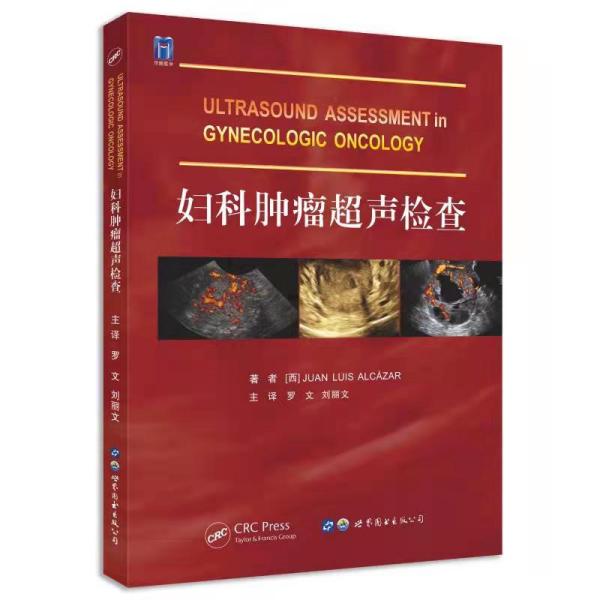 妇科肿瘤超声检查