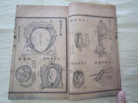 稀见清末民初线装老版活字排印本“医学名篇”《妇婴新说》（插图本），【英】合信 著 ；【清】管茂材 同撰，32开线装一册全。“妇婴新说”乃西学中用医学名篇，内录大量“妇科、儿科”医案、良方，并附精美版画插图数幅，图文并茂。版本罕见，品如图。