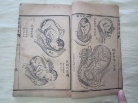 稀见清末民初线装老版活字排印本“医学名篇”《妇婴新说》（插图本），【英】合信 著 ；【清】管茂材 同撰，32开线装一册全。“妇婴新说”乃西学中用医学名篇，内录大量“妇科、儿科”医案、良方，并附精美版画插图数幅，图文并茂。版本罕见，品如图。