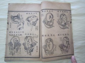 稀见清末民初线装老版活字排印本“医学名篇”《妇婴新说》（插图本），【英】合信 著 ；【清】管茂材 同撰，32开线装一册全。“妇婴新说”乃西学中用医学名篇，内录大量“妇科、儿科”医案、良方，并附精美版画插图数幅，图文并茂。版本罕见，品如图。