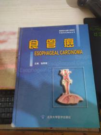 食管癌