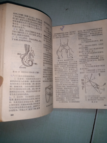 **32开上海版《赤脚医生手册》（看图和描述）