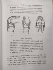 全膝关节置换软组织平衡图谱