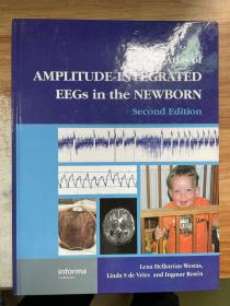 atlas of amplitude integrated eegs in the newborn