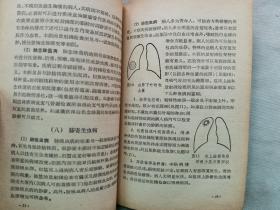 1964年 齐仁安著 江苏人民出版社《咳血的诊断与治疗》一册全！