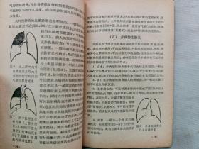 1964年 齐仁安著 江苏人民出版社《咳血的诊断与治疗》一册全！