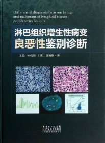 淋巴组织增生性病变良恶性鉴别诊断