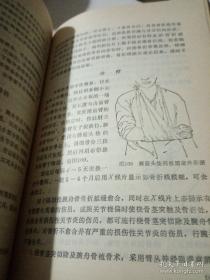 李广海在伤者波兰专家毫无紧张的状态下，突然施展复位手术。伤者刚一皱眉，李对他说：“你肩关节已复位”波兰专家试摆动手臂，已完全自如——虽署名佛山市中医院骨科，真实是广东骨科名家李广海的一生骨科经验。本书首次公布的佛山市中医院骨科常用有效方剂五十四条，真实为李广海经验方。所列集体作者中，第一作者李家达为李广海的嫡传亲子；第二作者陈渭良，1957年投奔李广海，成为李氏骨科第五代传人。