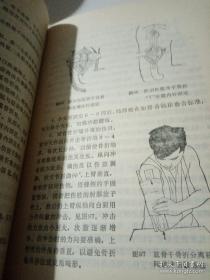 李广海在伤者波兰专家毫无紧张的状态下，突然施展复位手术。伤者刚一皱眉，李对他说：“你肩关节已复位”波兰专家试摆动手臂，已完全自如——虽署名佛山市中医院骨科，真实是广东骨科名家李广海的一生骨科经验。本书首次公布的佛山市中医院骨科常用有效方剂五十四条，真实为李广海经验方。所列集体作者中，第一作者李家达为李广海的嫡传亲子；第二作者陈渭良，1957年投奔李广海，成为李氏骨科第五代传人。