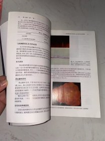 视网膜脱离原理与实践（第3版） 有写画