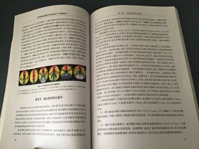 急性缺血性脑卒中多模式CT检查技术