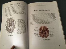 急性缺血性脑卒中多模式CT检查技术