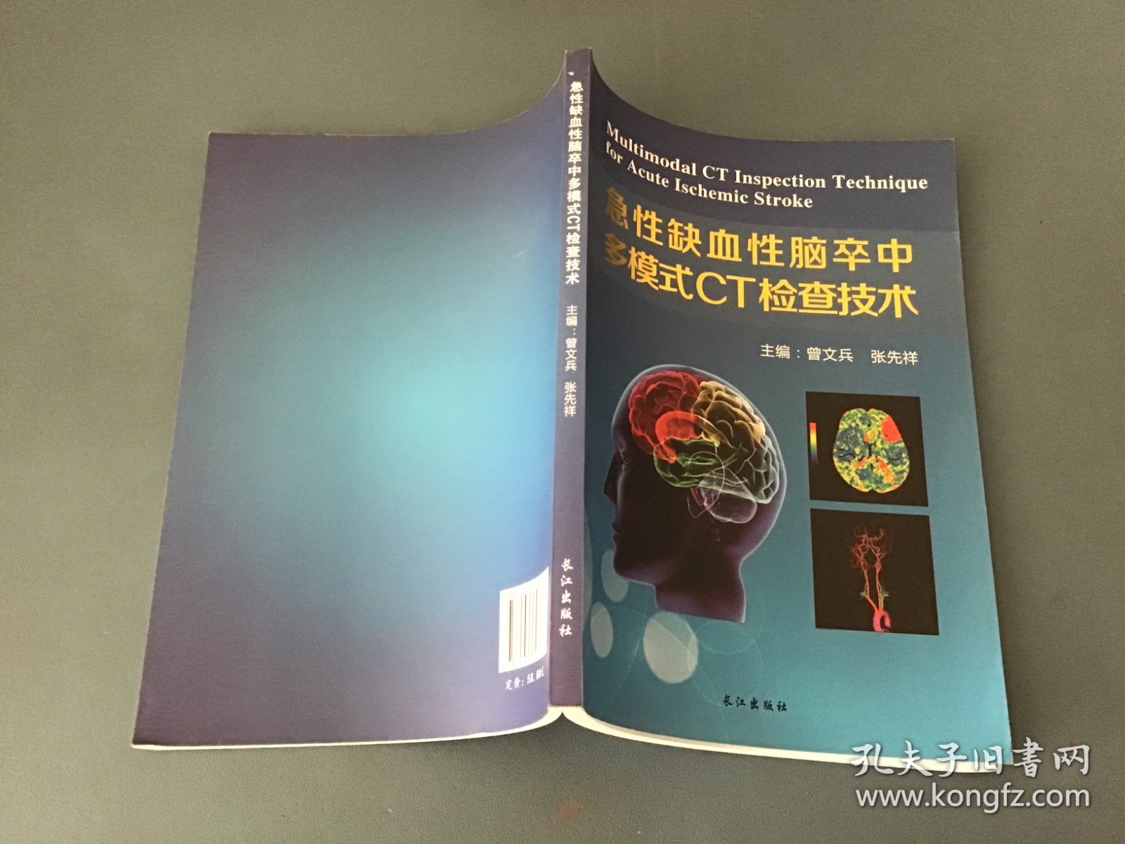 急性缺血性脑卒中多模式CT检查技术